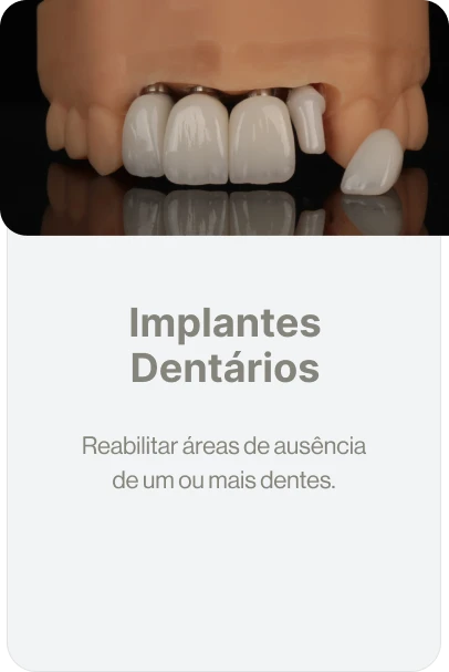 implantes dentarios