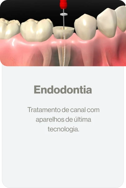 endodontia